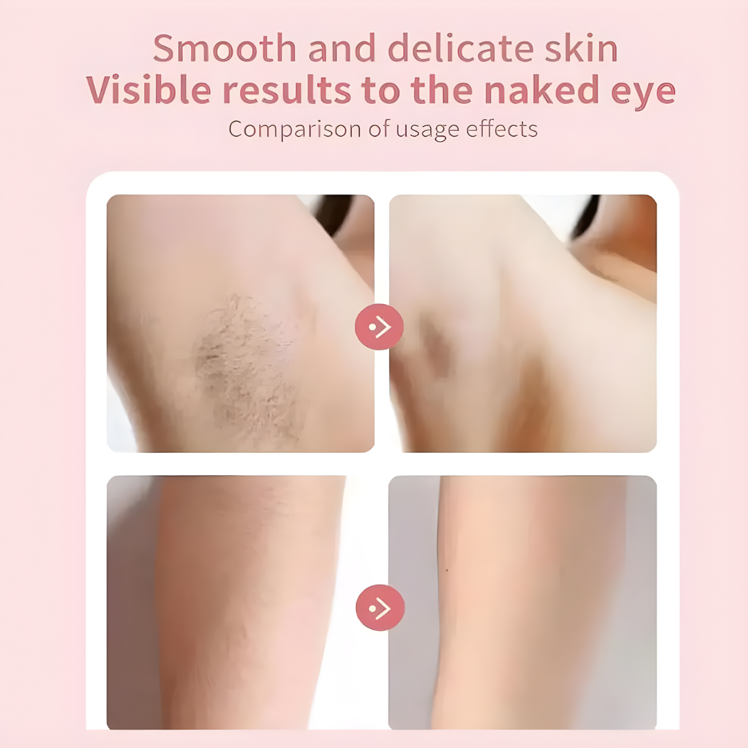 HairRemover: Oplaadbaar Epilator Pijnloos Elektrisch Haar Verwijdering Apparaat