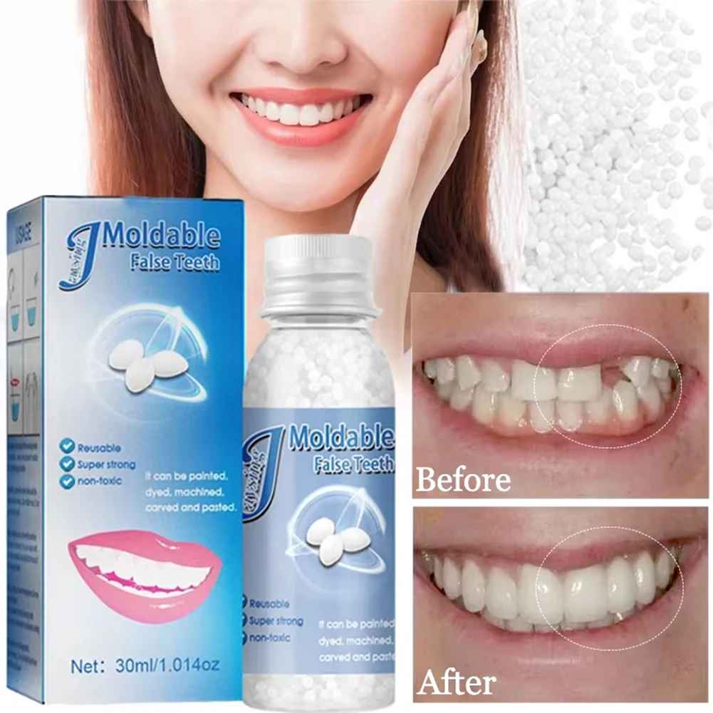 TeethRepair™ 1+1 GRATIS: Natuurlijk-Uitziende Tanden Reparatiekit