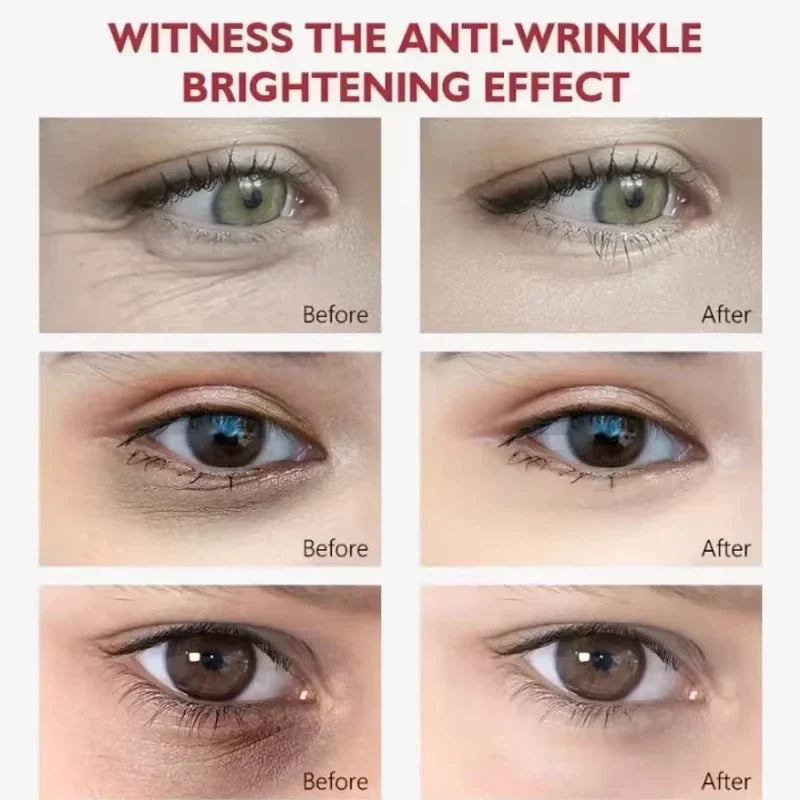 EyeCream 1+1 GRATIS: Hydraterend Verstevigend Anti-Donkere kringen Oog Crème Serum