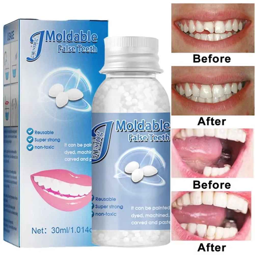 TeethRepair™ 1+1 GRATIS: Natuurlijk-Uitziende Tanden Reparatiekit