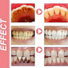 ProbioticToothpaste 1+1 GRATIS: Teder Whitening Versterkende Probiotica Tandpasta