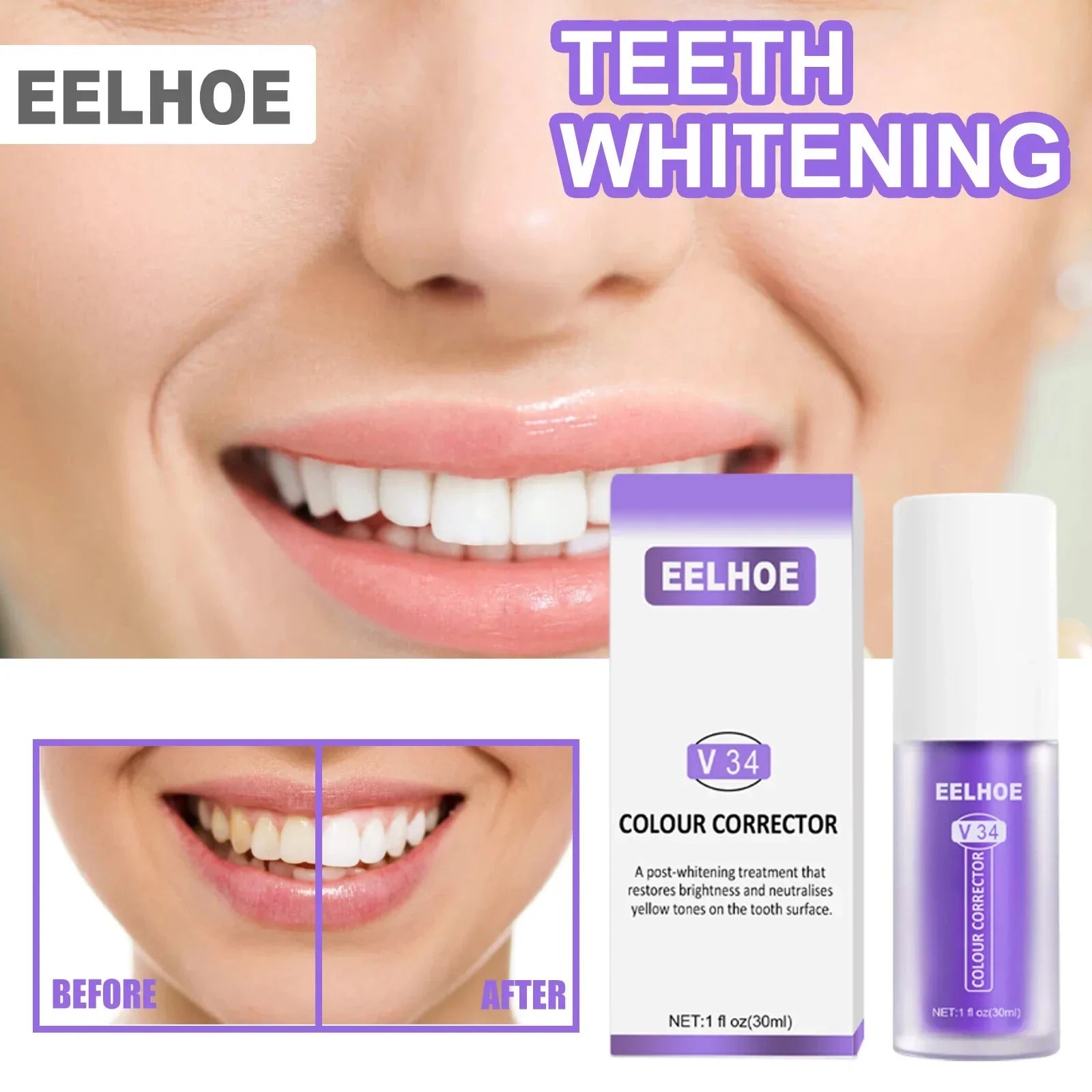 TeethSerum - Tanden Witmakend En Bescherming Serum