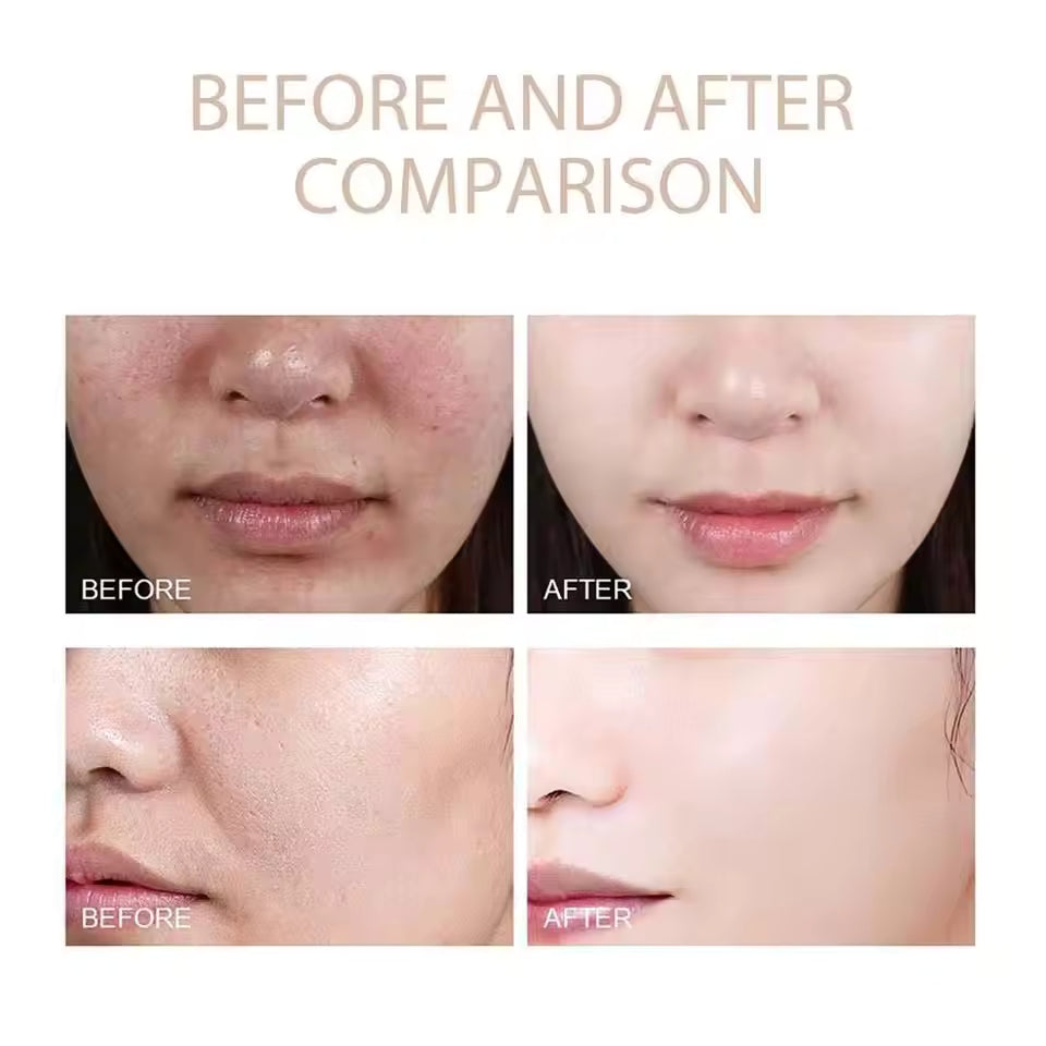 ExfoliatingSerum 1+1 GRATIS: Gemakkelijk Te Gebruiken Zacht Exfoliërende Ampul Voor De Gevoelige Huid