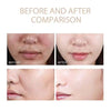 ExfoliatingSerum 1+1 GRATIS: Gemakkelijk Te Gebruiken Zacht Exfoliërende Ampul Voor De Gevoelige Huid